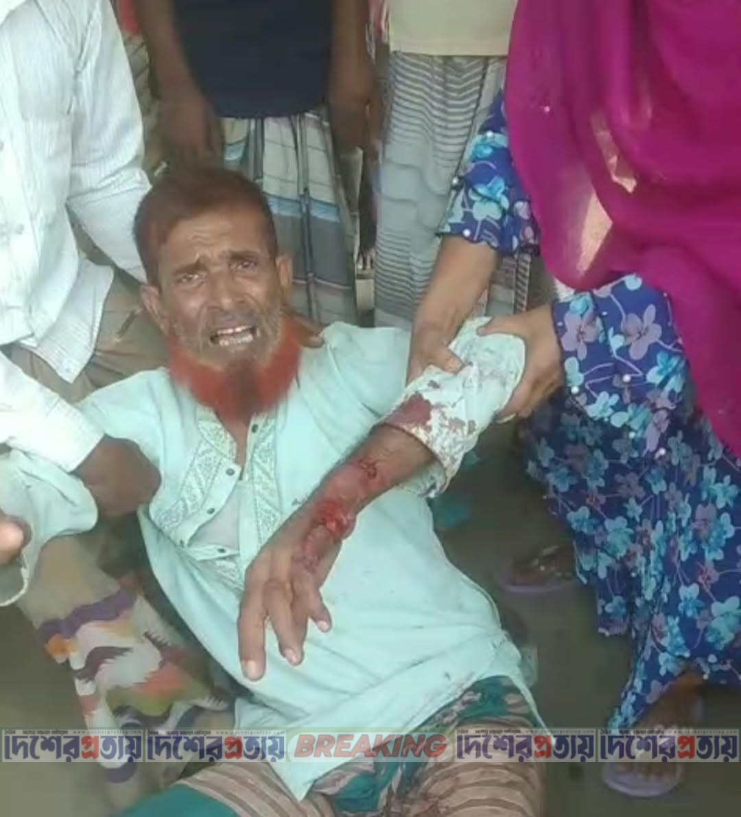 মোহনপুরে বিএনপি নেতাকে কুপিয়ে হত্যা চেষ্টা আইনশৃঙ্খলা নিয়ে উদ্বেগ